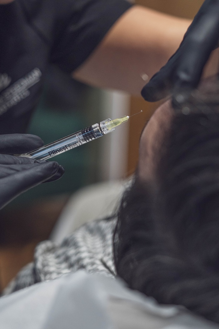 dermal filler in jesmond